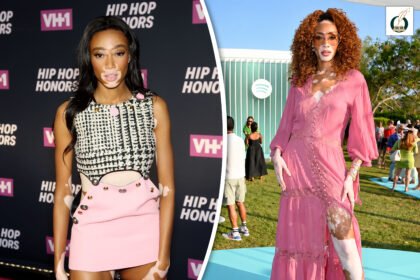 Winnie Harlow
